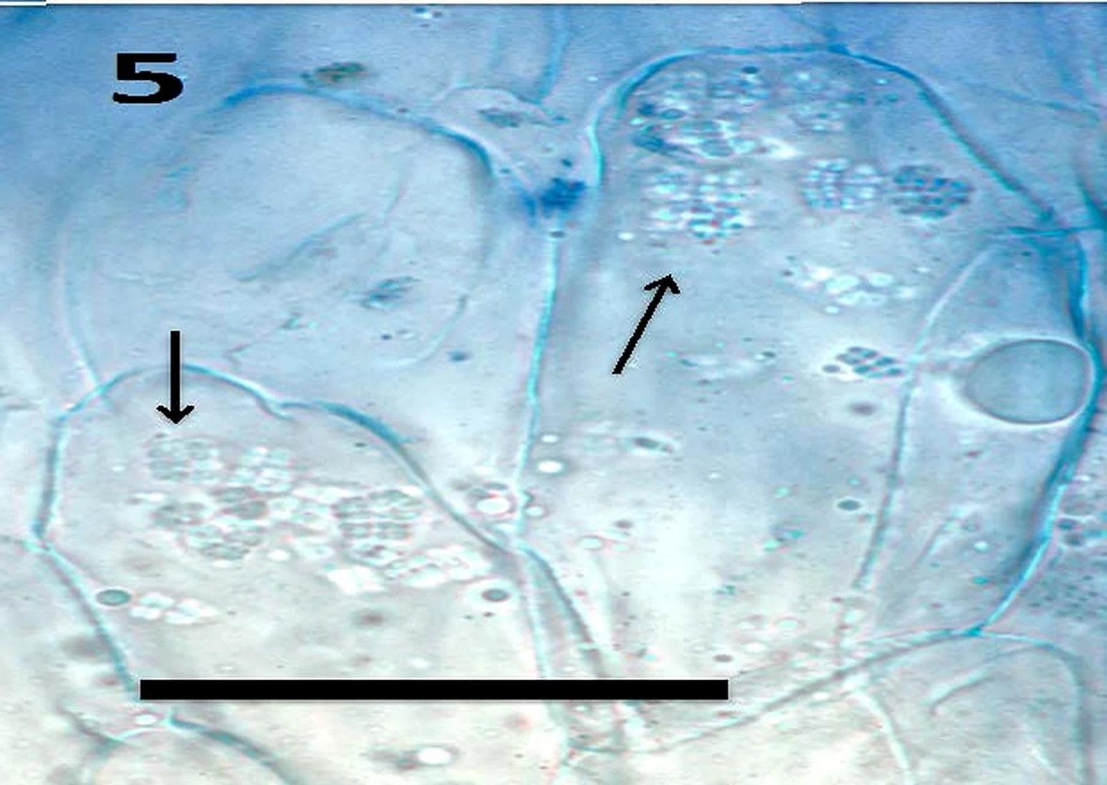Light micrograph of plant root cells containing clusters of microbes, arrowed, with a published scale bar.