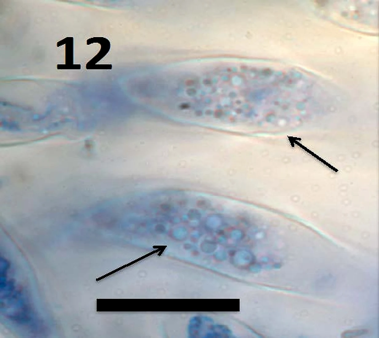 Light micrograph of wall-less microbial forms within root cells, arrowed, with a published scale bar.