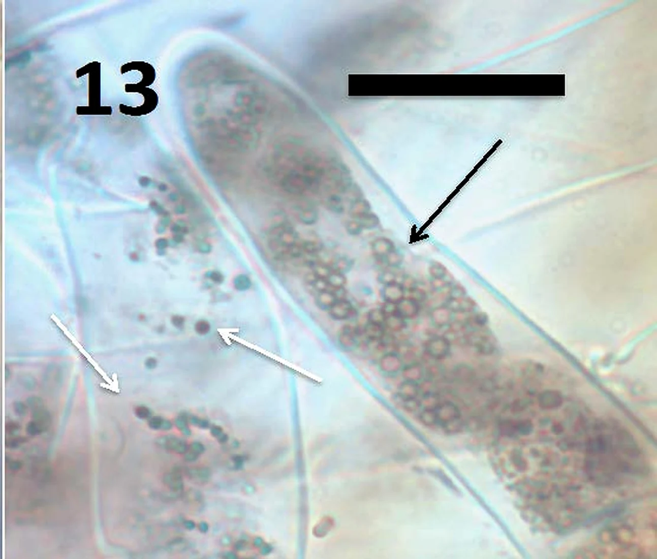 Light micrograph of a grass seedling root hair containing bacteria, arrowed, with smaller spherical wall-less forms also visible.